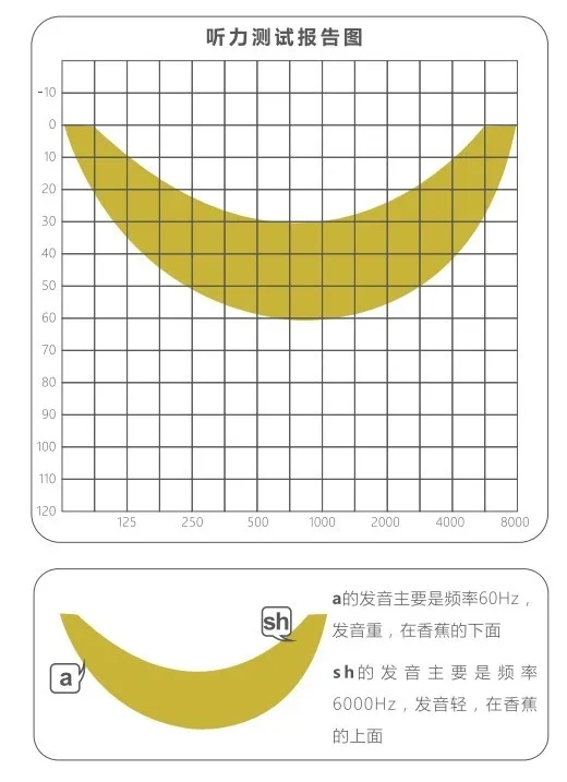 专家讲堂听力康复难道只是戴助听器这么简单吗